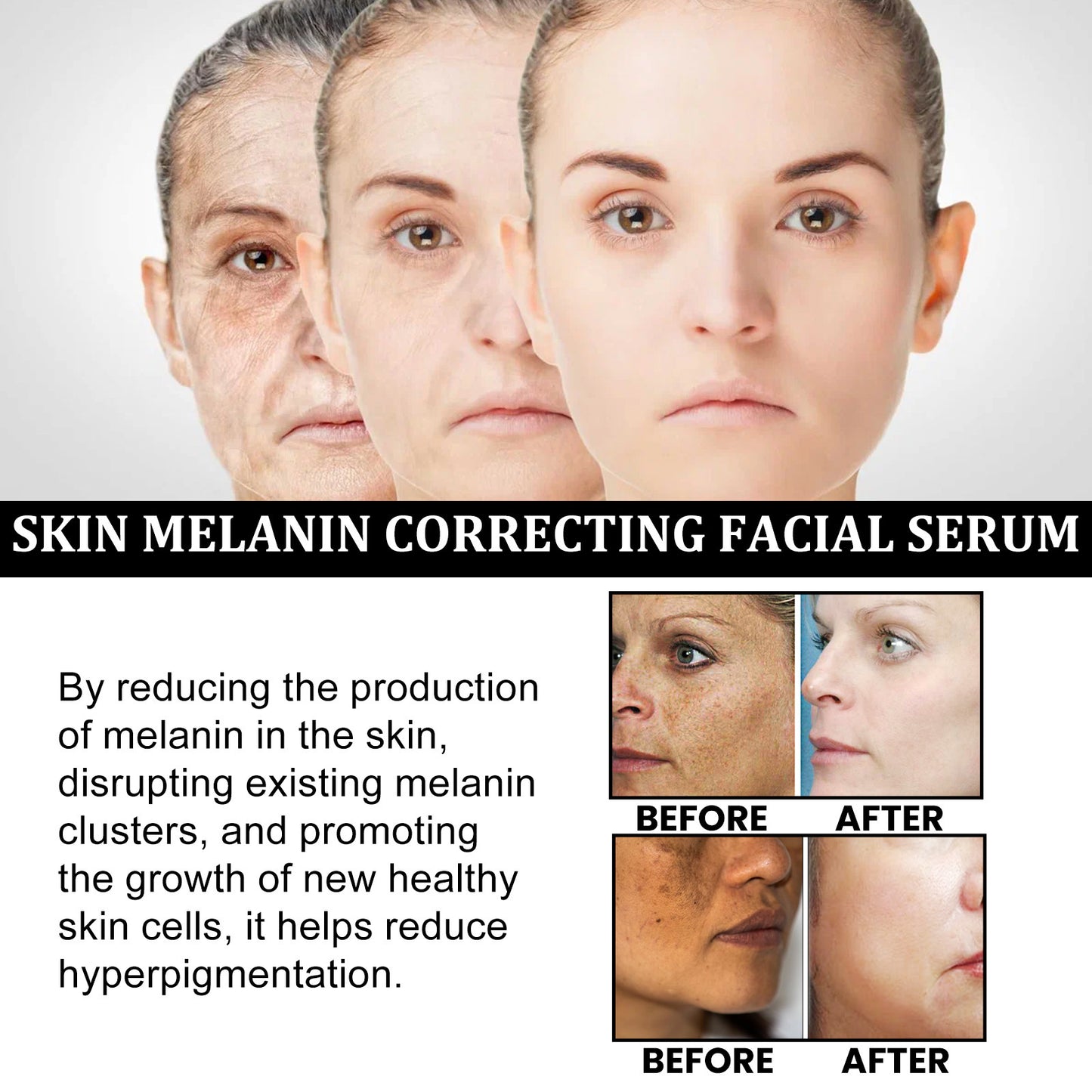 Facial Melanin Repair Hydrating Skincare