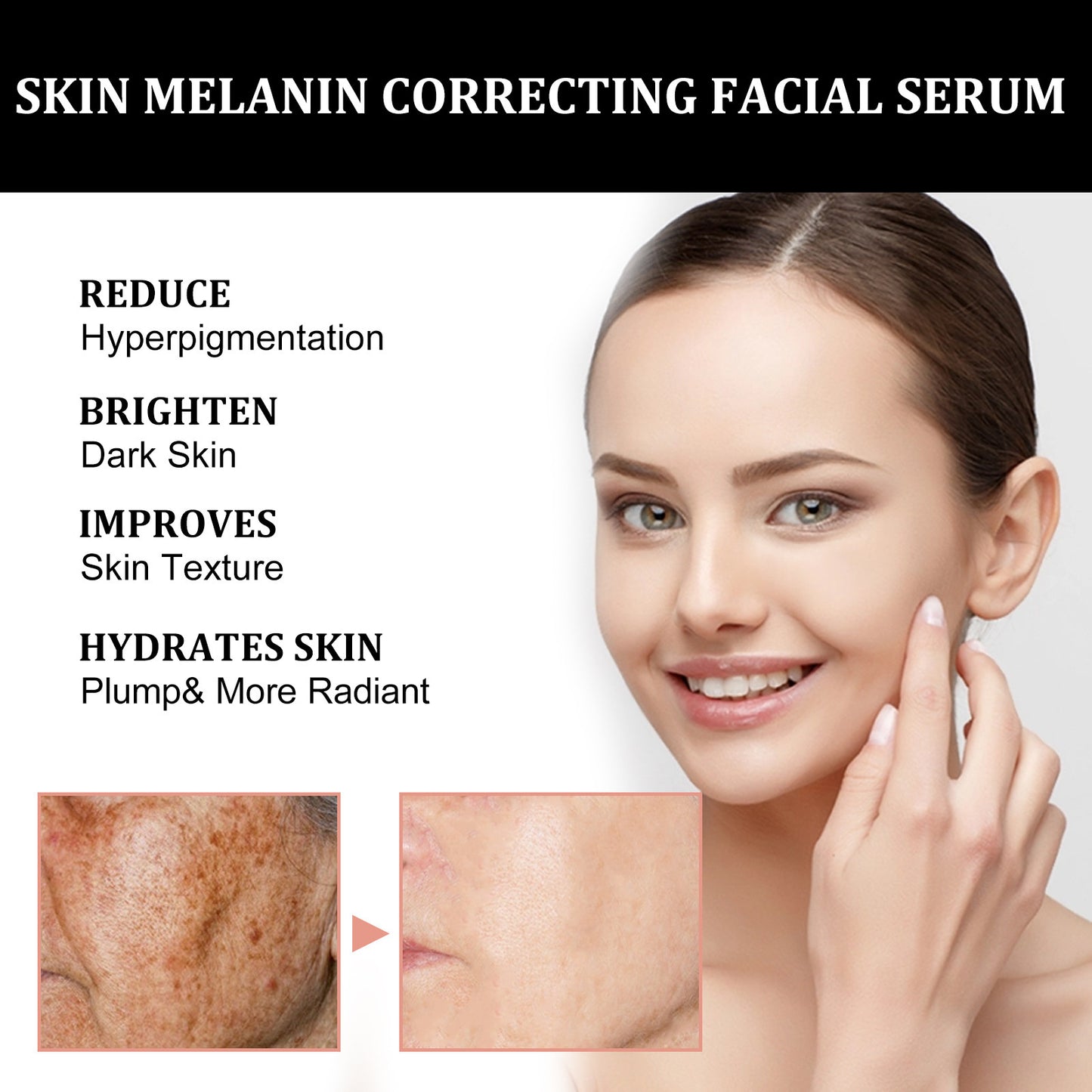 Facial Melanin Repair Hydrating Skincare